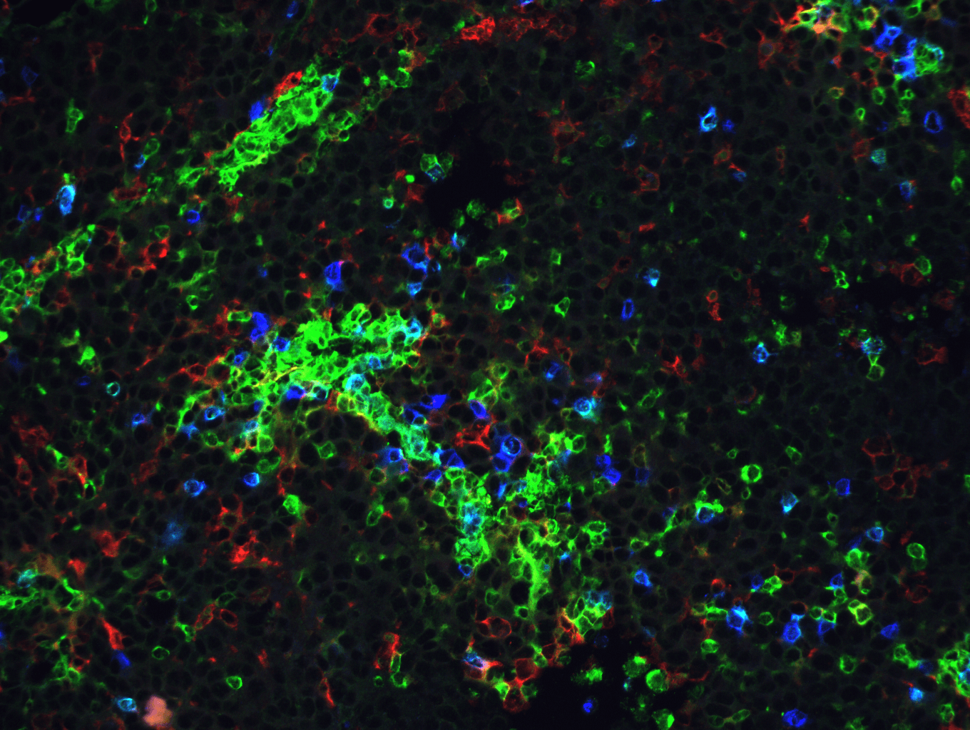 図*. 腫瘍の免疫染色.