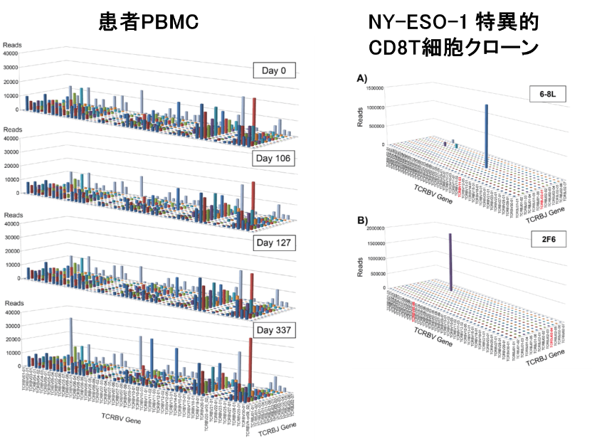 患者PBMC/NY-ESO-1 特異的CD8T細胞クローン