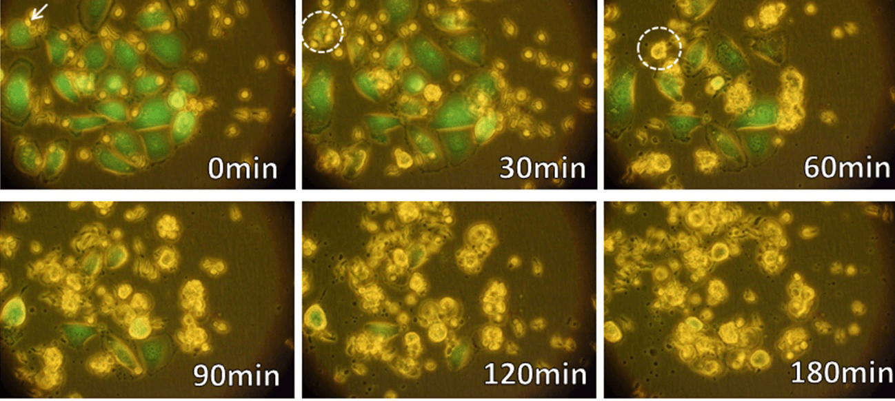γδT細胞（緑：生きたがん細胞、死んだがん細胞は色を失う。→：γδT細胞）