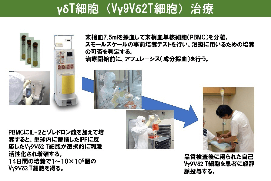 γδT細胞（Vγ9Vδ2T細胞）治療