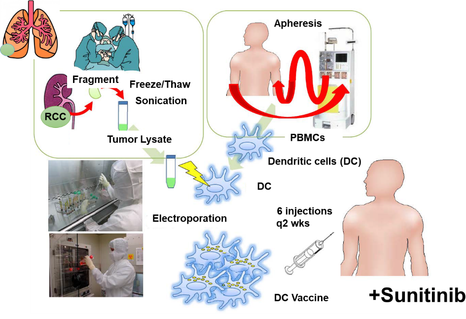 スニチニブは、抑制性T細胞（Treg）やMDSCなどの抑制性細胞を減少させることから、樹状細胞ワクチンとの併用で、相乗効果・相加効果が期待